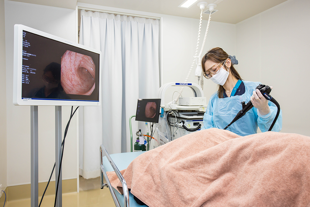 大腸カメラ検査（大腸内視鏡検査）とは