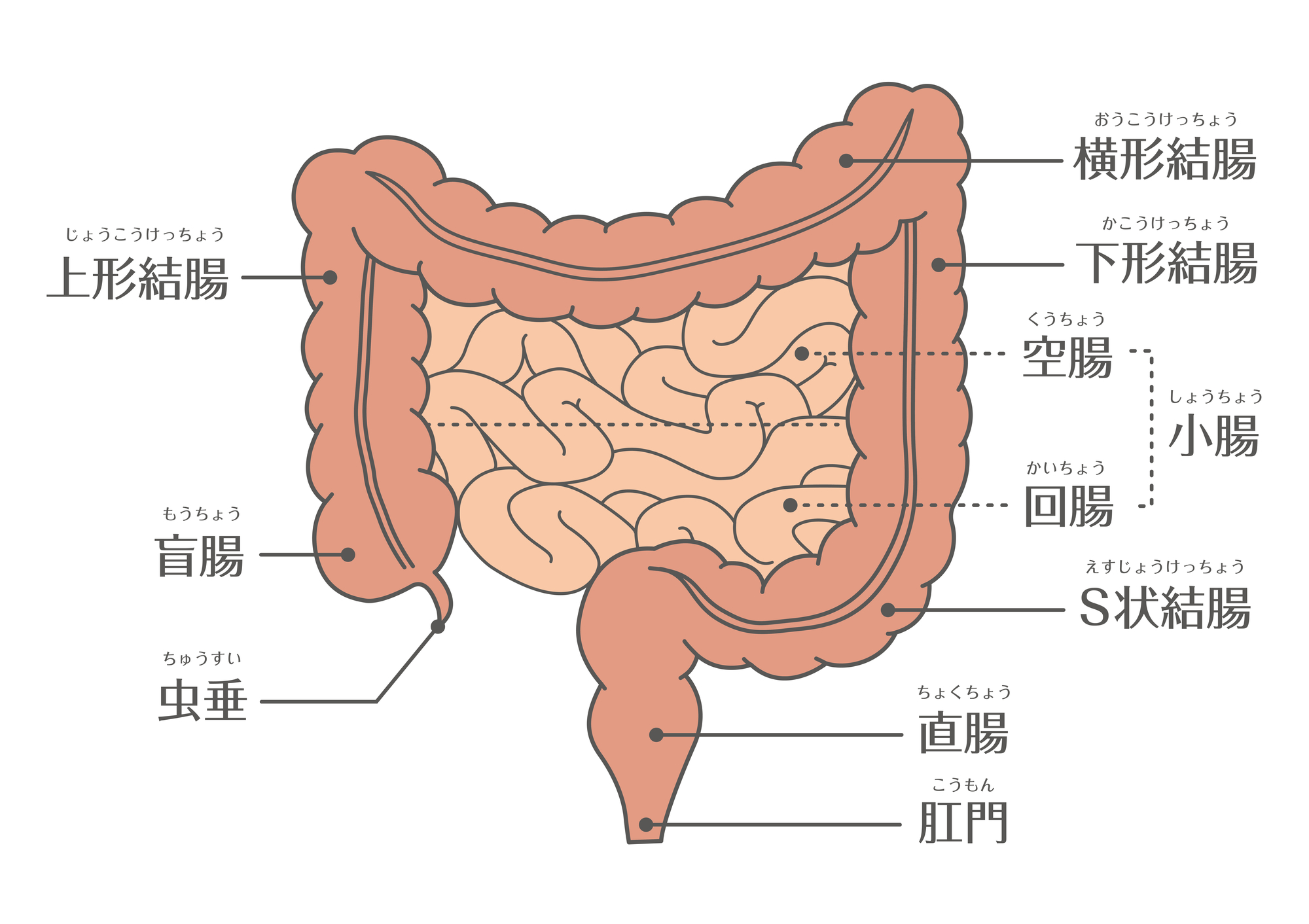 大腸がんにどうしてなるの？